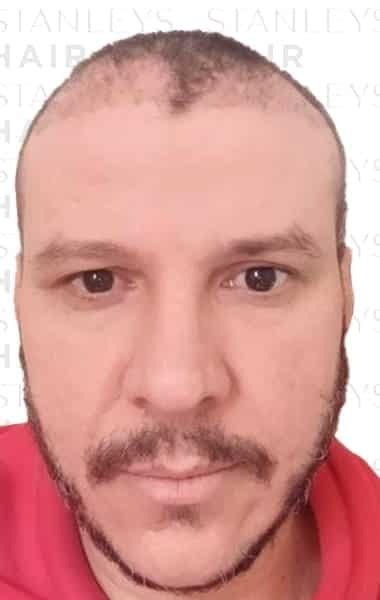 Antes