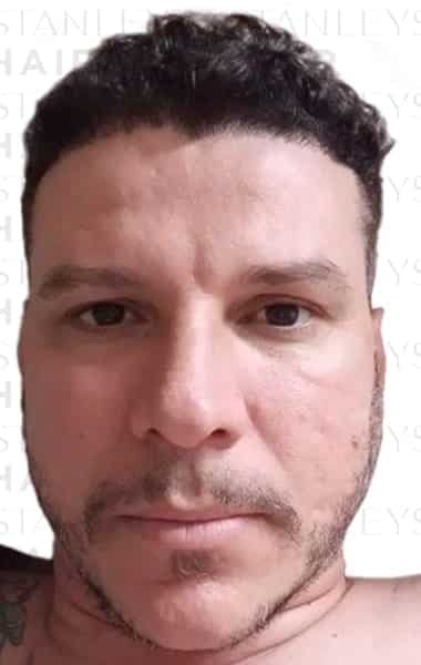 Depois