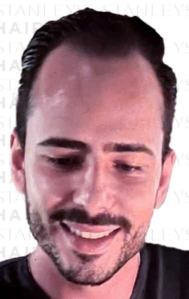 Antes